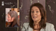 Client L discusses Alopecia