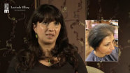 Client R discusses hair loss caused by illness