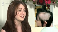 Videos about Trichotillomania