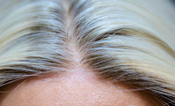 close-up of Rachel's hair line