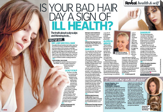 My weekly Trichotillomania article
